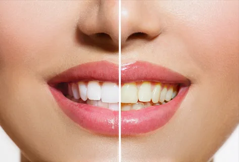 Risks And Benefits Of Cosmetic Dental Surgery