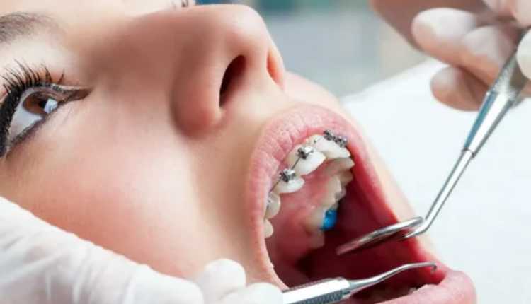Unveiling Excellence: Finding The Best Orthodontist In Vijayawada