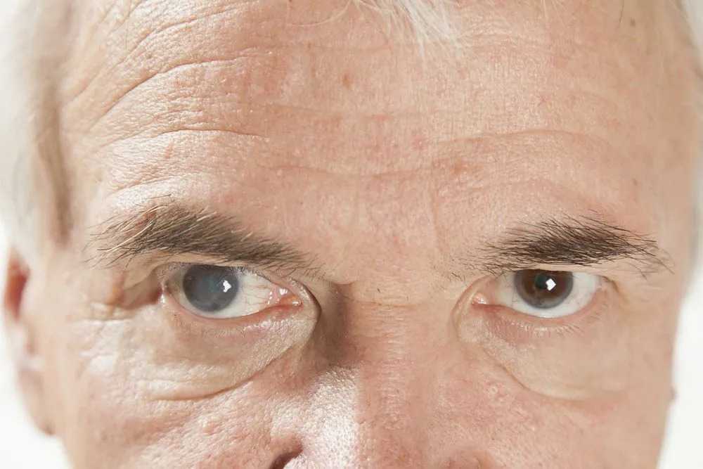 Affordable Cataract Surgery: What Patients Should Know Before Treatment