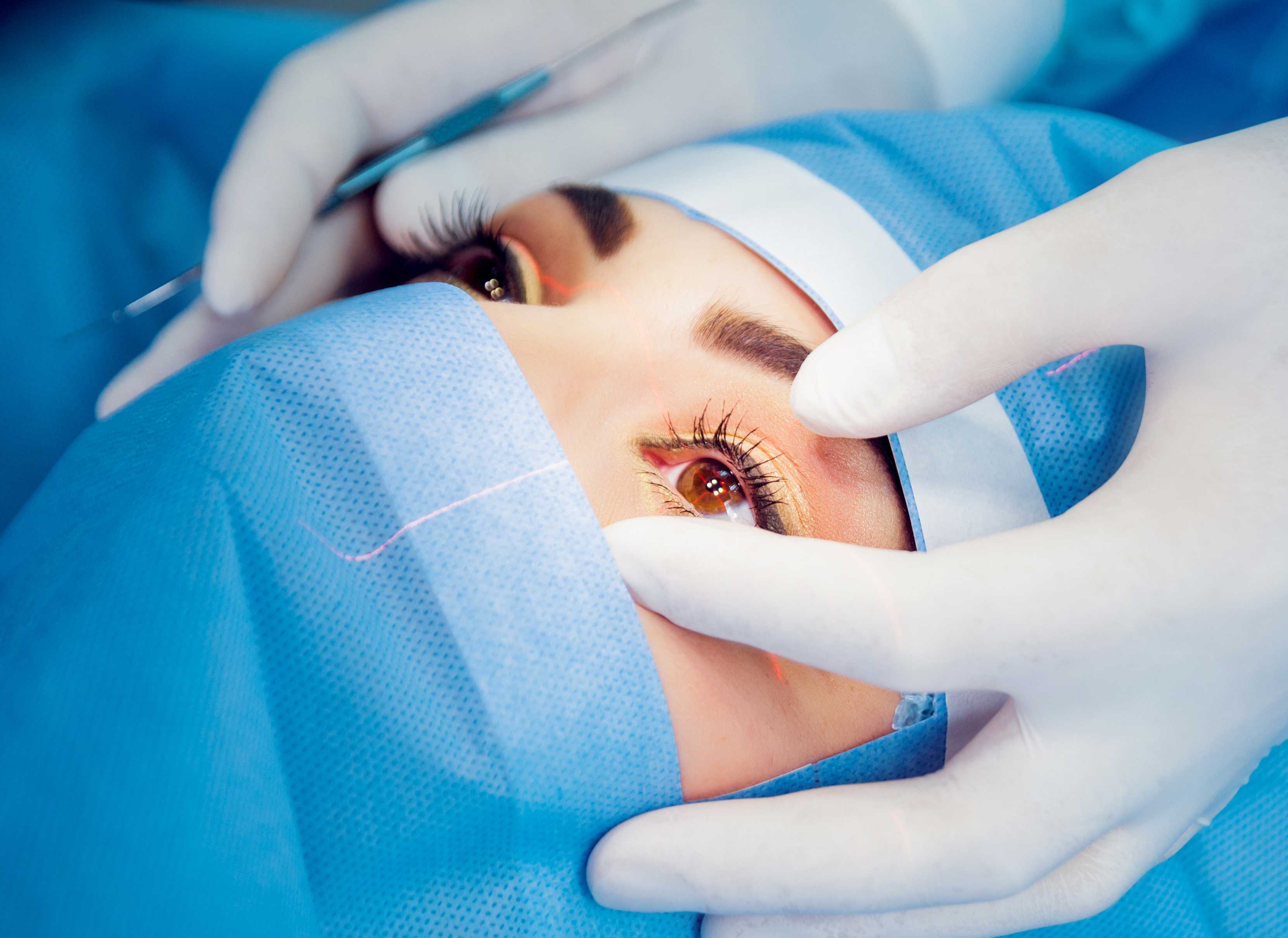 LASIK Recovery: Tips For A Smooth Healing Process