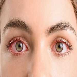 Dry Eye Syndrome And LASIK Surgery: What Chinchwad Ophthalmologists Check Before Proceeding