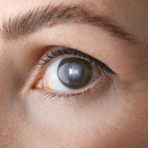 Motibindu Surgery: Everything You Need To Know Before Treatment