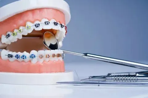 Orthodontic Treatment Explained: Options, Benefits, And Ideal Age To Start