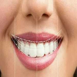 Smile Designing: Transform Your Look With Customized Dental Aesthetics