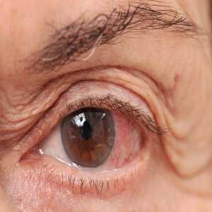 The Importance Of Early Detection In Glaucoma Management